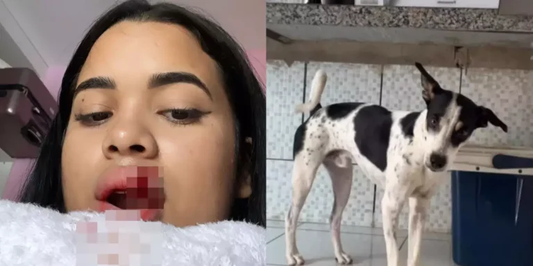 Jovem tem parte do lábio arrancado após tentar beijar cachorro no PI