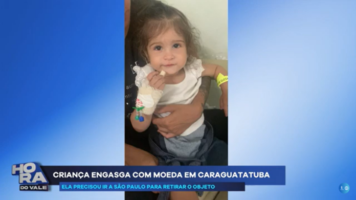 Bebê de 1 ano fica 56h com moeda na garganta após engasgo