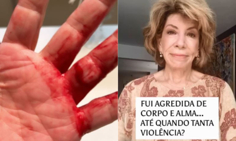 Silvia Poppovic leva ‘mata leão’ e tem anel roubado durante assalto em São Paulo; VÍDEO
