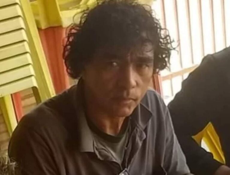 Campanha online visa arrecadar fundos para tratamento de homem que teve nariz decepado em acidente de moto