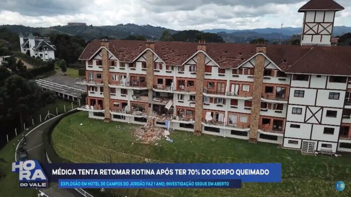 WhatsApp Image 2024-04-22 at 14.48.41 Vítima ainda trata queimaduras um ano após explosão em Campos do Jordão