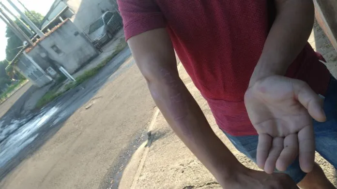 Na avenida Campos Sales no Bairro Vila Frezzarin em Americana um motoboy se feriu ao cai de moto depois de se enroscar em fios soltos.