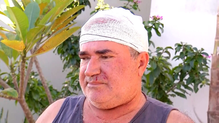 Exclusivo: idoso vítima de agressão em tentativa de assalto relata luta corporal com bandido
