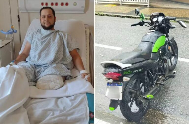 Acidente: Motoboy tem perna amputada após atropelar cachorro em São Vicente