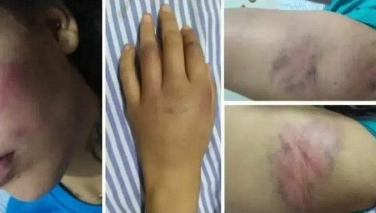 Suspeito de agredir companheira e abandoná-la em pronto-socorro é preso na rodoviária de Clementina