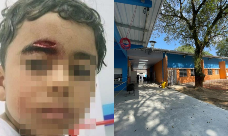 Criança de 5 anos é atingida por porta de banheiro da escola