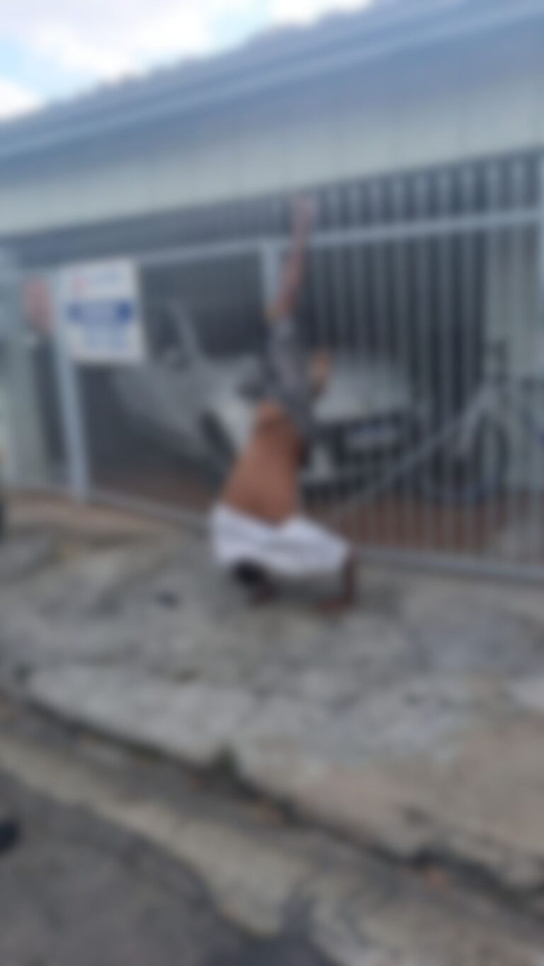 Homem tenta pular do portão para furtar e enrosca a perna