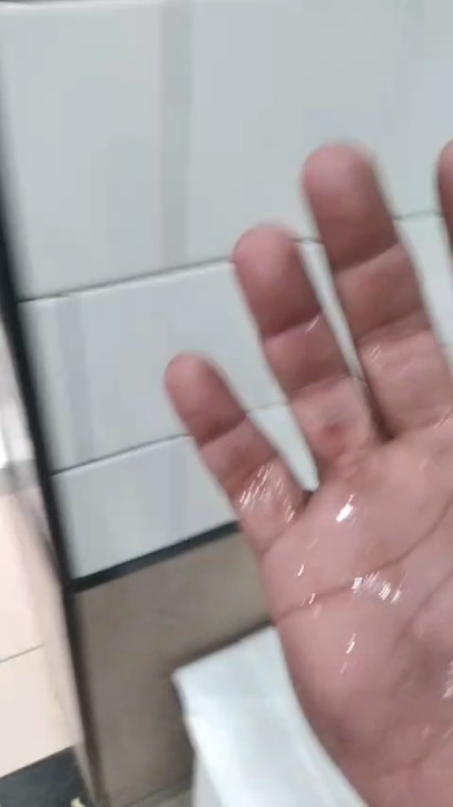 Motoboy é agredido com óleo quente por atendente de fast food