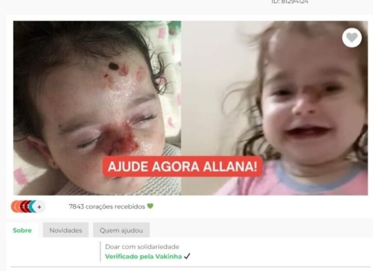 Mãe denuncia “vaquinha virtual” falsa para tratamento de criança com doença rara