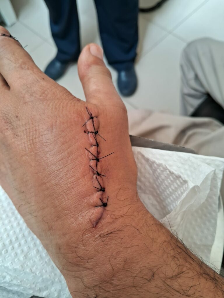 Vítima de 54 anos levou diversas facadas na coxa, ombro e braço após briga de trânsito em Itatiba.