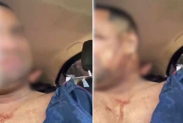 Motorista de aplicativo é sequestrado, leva tiro no ombro e é salvo pela polícia militar; VÍDEO