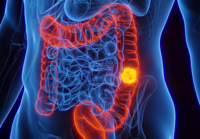 002-Saiba-mais-sobre-o-cancer-de-vesicula-biliar-e-das-vias-biliares-CAPA-1