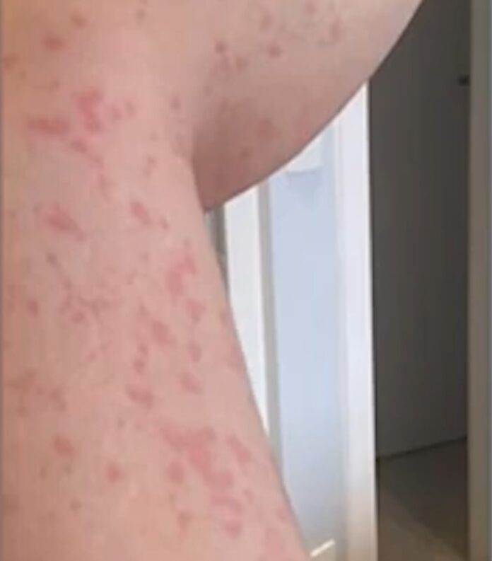 Só esse ano já foram registrados 15 casos