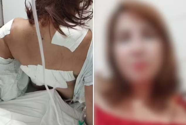 Mulher é esfaqueada 17 vezes por marido que havia acabado de ser demitido