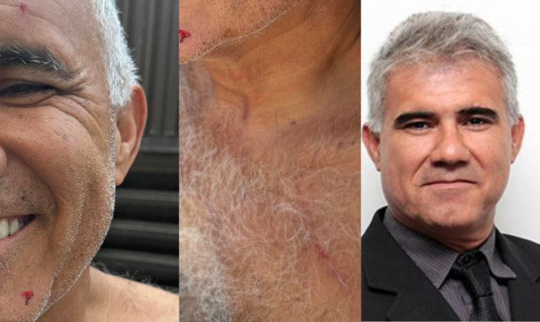 Vice-prefeito de Praia Grande é assaltado no meio do trânsito na cidade e criminosos são presos