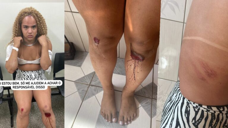 “Não tinha percebido que era traveco”: Jovem de 22 anos fica ferida ao ser violentada por motorista não identificado