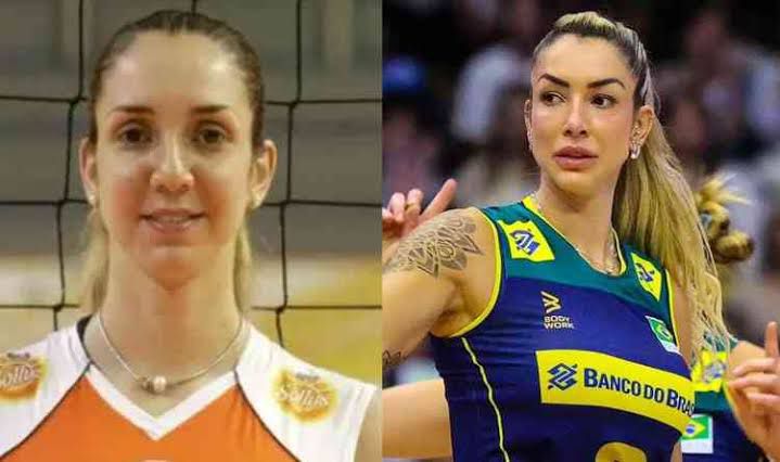 A transformação de Thaisa do Vôlei: Como a harmonização full face pode transformar a aparência sem intervenções cirúrgicas