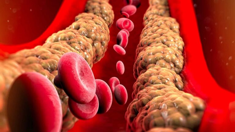 Atendimentos a pacientes com colesterol alto cresce 41% no SUS de SP