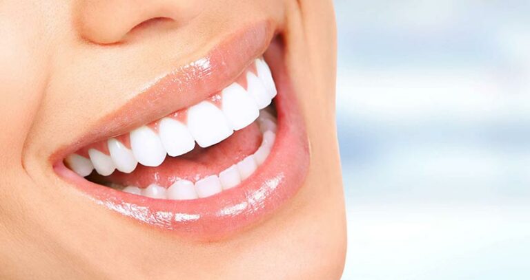 Procura por lentes de porcelana para os dentes aumenta 64% em dois anos