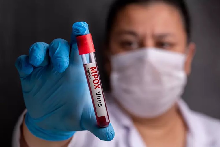 Cubatão tem o primeiro caso confirmado de Mpox na Baixada Santista