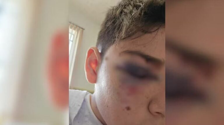 Adolescente é agredido por colega dentro de sala de aula em Birigui
