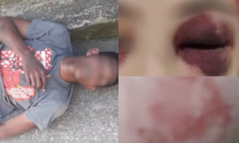 Ladrão é preso dois dias depois de dar socos, chutes e mordidas em adolescente que reagiu a assalto em Mongaguá