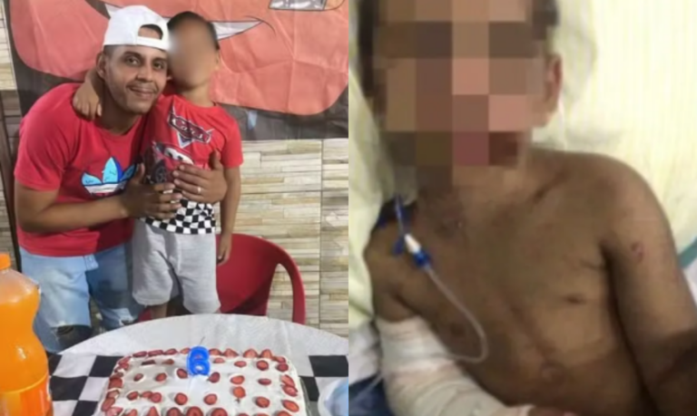 Pai consegue guarda de menino que teve braço e costelas quebradas pela mãe e padrasto em São Vicente