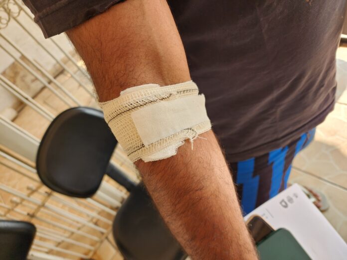 Morador de rua foragido invade casa e morde braço da vítima em Limeira