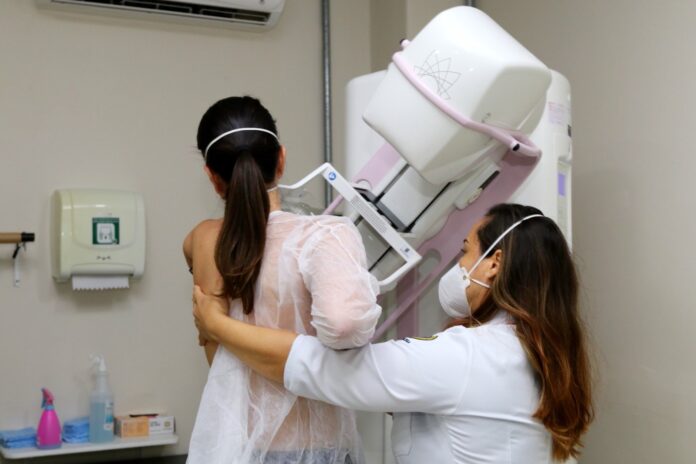 Prefeitura de Jacareí realiza mutirão de mamografias aos sábados