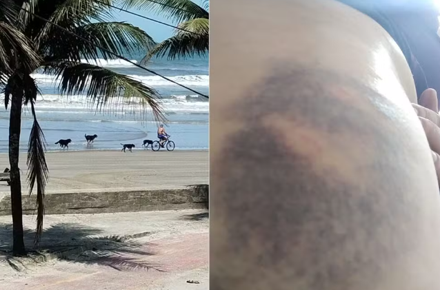 ‘Quadrilha’ de cães colocam terror em praia de Mongaguá e mordem 5 banhistas