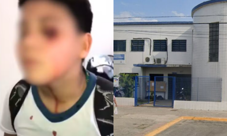 Menino de 12 anos, vítima de bullying, leva soco em saída de escola e era chamado de ‘autista balofo’; VÍDEO