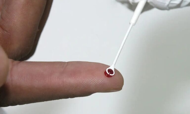 Em Ribeirão Preto, campanha “Fique Sabendo” promove testagem para HIV e Sífilis neste sábado