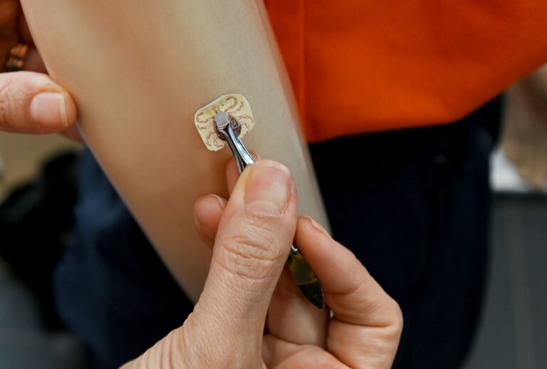 Febre maculosa em Campinas