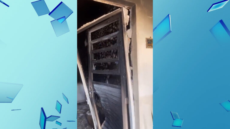 Mulher tem 70% do corpo queimado em Sumaré; companheiro é suspeito