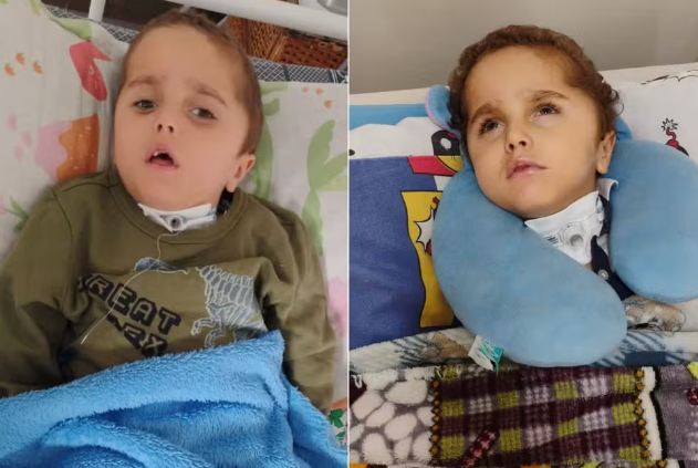 Família aguarda há 6 meses por remédio à base de canabidiol para tratamento de criança com convulsões diárias