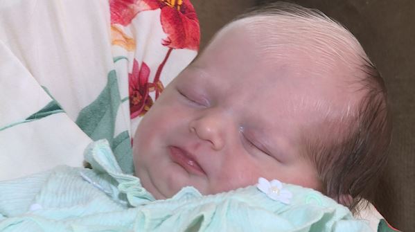 Bebê com o cabelo bicolor: você sabe o que é o Piebaldismo?