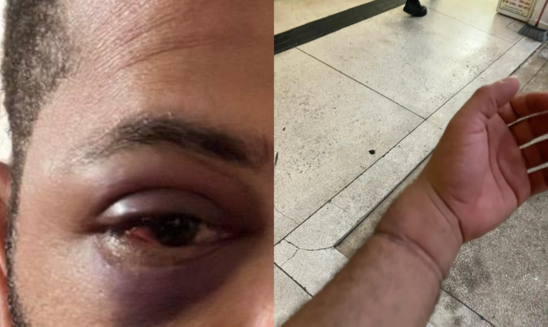 Homem negro acusa PM de racismo após abordagem violenta em Santos