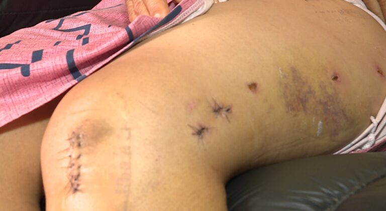 Após 9 dias na UTI, idosa atropelada ao sair da igreja volta para casa e família clama por justiça