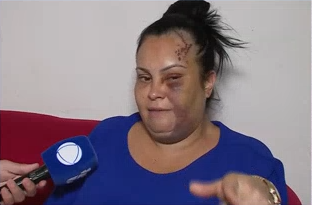 Vítima de tentativa de feminicídio em Piracicaba tem alta e fala pela primeira vez: 