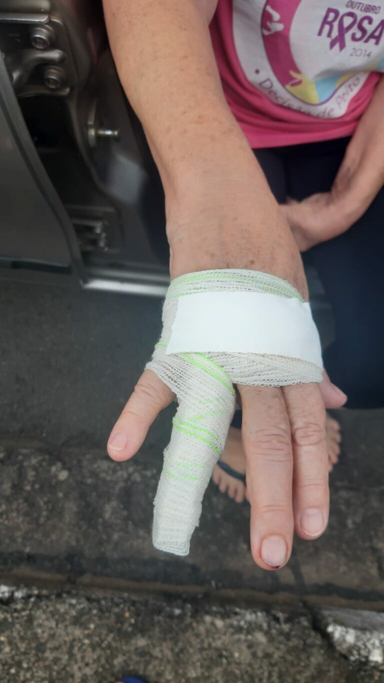 Idosa fica ferida ao se enroscar em fiação solta na rua