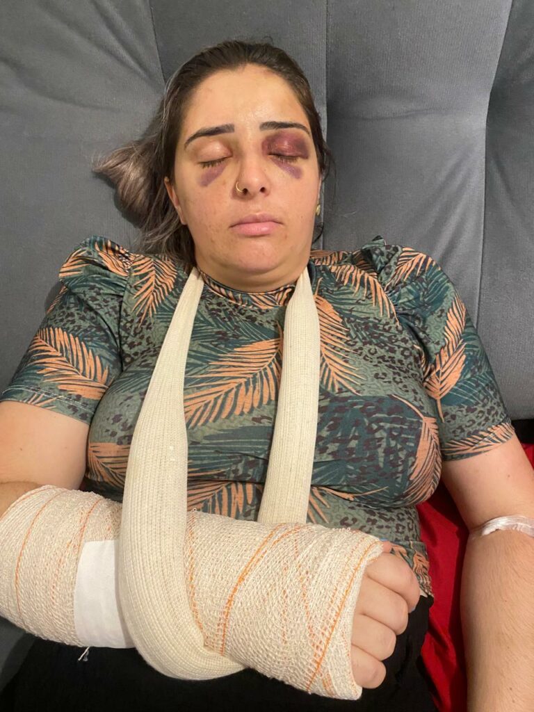 Homem suspeito de quebrar o pulso de ex-companheira é preso em São José