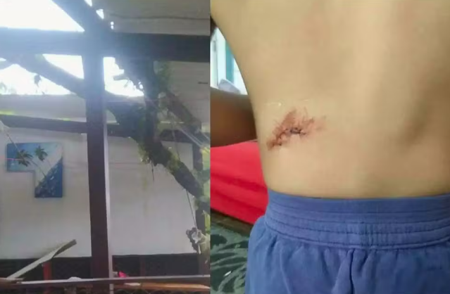 Criança de 3 anos fica ferida após galho de quase 8 metros atingir casa em Guarujá