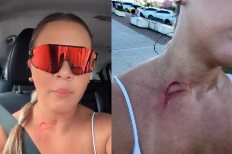 Mulher fica ferida no pescoço após ter corrente de ouro roubada em cidade do litoral