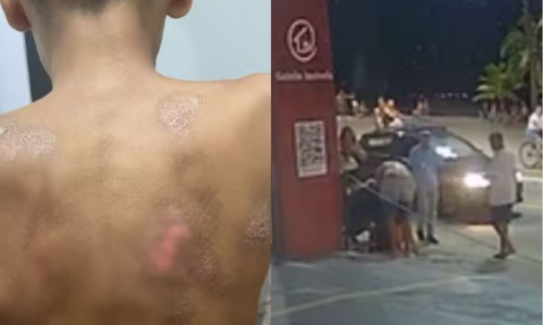 Motorista de carro de luxo foge após atropelar criança em cidade do litoral de SP; VÍDEO