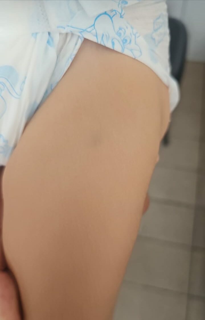 Bebê de 1 anos e meio é vítima de tortura e maus tratos em Campinas