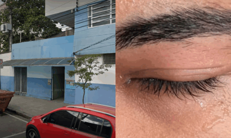 Aluno é agredido em escola de Santos e sofre inflamação no olho