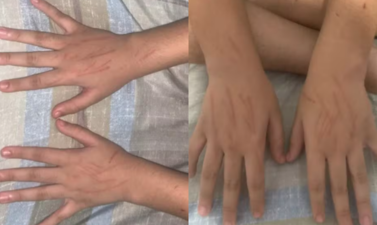 Menino de 12 anos é agredido em saída de escola de Praia Grande