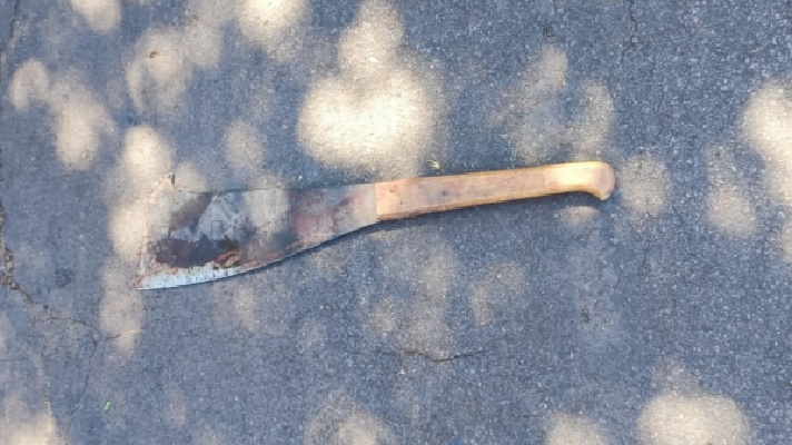 Homem é atacado com facão em Adamantina e corre risco de perder as pernas