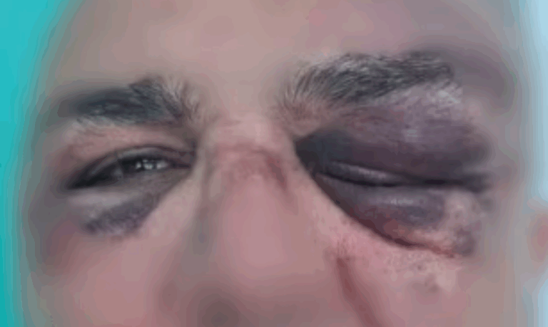 Aposentado afirma ter sido agredido “do nada” por vizinho em Santos