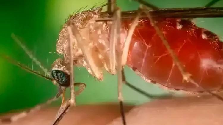 Ubatuba registra primeiro caso de febre Oropouche